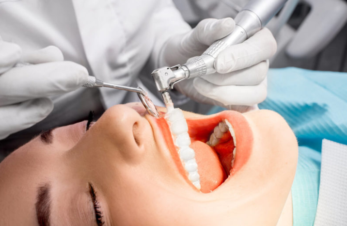 Teeth Cleaning