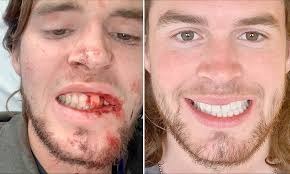 Road Accident Facial Management