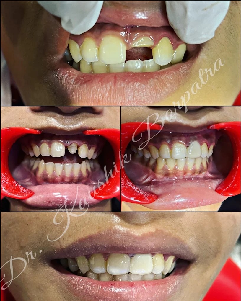 Patient smile transformation